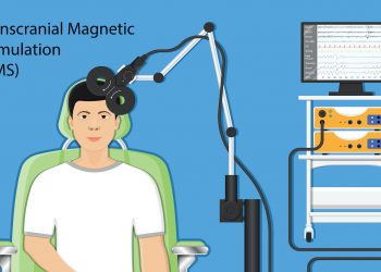 Transcranial Magnetic Stimulation
